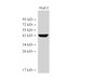 Western Blot analysis of HepG2 cells using MVD Polycloanl Antibody at dilution of 1:1000