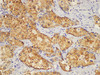Immunohistochemistry of paraffin-embedded Human liver using MVD Polycloanl Antibody at dilution of 1:100