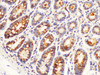 Immunohistochemistry of paraffin-embedded Rat colon using IGFBP1 Polycloanl Antibody at dilution of 1:100