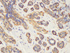 Immunohistochemistry of paraffin-embedded Human breast using KLK2 Ployclonal Antibody at dilution of 1:200.