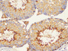 https://file.elabscience.com//image/antibody/EA/E-AB-40368-IHC03.jpg