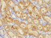 https://file.elabscience.com//image/antibody/EA/E-AB-40371-IHC03.jpg