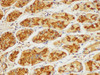 Immunohistochemistry of paraffin-embedded Human stomach using ST14 Ployclonal Antibody at dilution of 1:100.