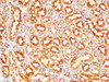 https://file.elabscience.com//image/antibody/EA/E-AB-40402-IHC04.jpg