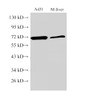 Western Blot analysis of A431 and Mouse liver using MMP2 Polyclonal Antibody at dilution of 1:1000