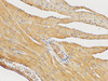 https://file.elabscience.com//image/antibody/EA/E-AB-40409-IHC03.jpg