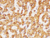 Immunohistochemistry of paraffin-embedded Human liver using FGG Polycloanl Antibody at dilution of 1:200