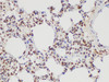 Immunohistochemistry of paraffin-embedded Rat lung using S100A6 Polycloanl Antibody at dilution of 1:100