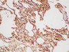 Immunohistochemistry of paraffin-embedded Human lung using GSTP1 Polycloanl Antibody at dilution of 1:100