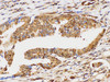 Immunohistochemistry of paraffin-embedded Human duodenum using UBC Polycloanl Antibody at dilution of 1:100