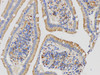 Immunohistochemistry of paraffin-embedded Human duodenum using ABL1 Polycloanl Antibody at dilution of 1:50