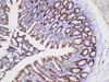 Immunohistochemistry of paraffin-embedded Rat colon using ABL1 Polycloanl Antibody at dilution of 1:50