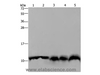 Western Blot analysis of Mouse pancreas tissue, Hela cell and Mouse liver tissue, A549 and 293T cell using UBB Polyclonal Antibody at dilution of 1:500