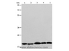 Western Blot analysis of Human brain malignant glioma tissue, MCF7, Raji, Lovo and 293T cell using BAX Polyclonal Antibody at dilution of 1:426