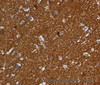 Immunohistochemistry of paraffin-embedded Human brain using SNCG Polyclonal Antibody at dilution of 1:60