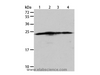 Western Blot analysis of Hela, A431, 293T and Jurkat cell using BAK1 Polyclonal Antibody at dilution of 1:900