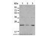 Western Blot analysis of A431 and A172 cell, Human liver cancer tissue using BNIP1 Polyclonal Antibody at dilution of 1:550