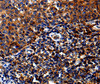 Immunohistochemistry of paraffin-embedded Human tosil tissue using IL13RA1 Polyclonal Antibody at dilution 1:50
