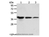 Western Blot analysis of A431, Hela and Raji cell using ANXA1 Polyclonal Antibody at dilution of 1:450