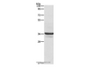 Western Blot analysis of Lovo cell using ANXA3 Polyclonal Antibody at dilution of 1:650
