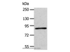 Western Blot analysis of A172 cell using APPL1 Polyclonal Antibody at dilution of 1:600