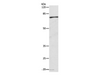 Western Blot analysis of Human fetal kidney tissue using CAPN1 Polyclonal Antibody at dilution of 1:500