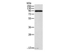 Western Blot analysis of A431 cell using CTNNA1 Polyclonal Antibody at dilution of 1:600