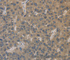 Immunohistochemistry of paraffin-embedded Human liver cancer using EMC8 Polyclonal Antibody at dilution of 1:30