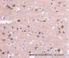 Immunohistochemistry of paraffin-embedded Human brain  tissue using DUSP13 Polyclonal Antibody at dilution 1:60