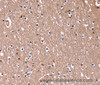 Immunohistochemistry of paraffin-embedded Human brain  using RDX Polyclonal Antibody at dilution of 1:60