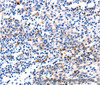 Immunohistochemistry of paraffin-embedded Human tonsil tissue using GADD45 gamma Polyclonal Antibody at dilution 1:120