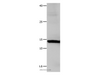 Western Blot analysis of Hela cell using Galectin 1 Polyclonal Antibody at dilution of 1:500