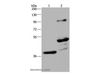 Western Blot analysis of Human fetal brain and Mouse brain tissue using GAS7 Polyclonal Antibody at dilution of 1:625