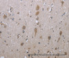 Immunohistochemistry of paraffin-embedded Human brain tissue using GPC6 Polyclonal Antibody at dilution 1:40