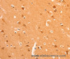 Immunohistochemistry of paraffin-embedded Human brain tissue using GRM3 Polyclonal Antibody at dilution 1:50
