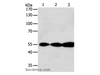Western Blot analysis of Jurkat, Hela and A549 cell using GSR Polyclonal Antibody at dilution of 1:750