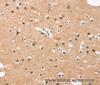 Immunohistochemistry of paraffin-embedded Human brain tissue using HDAC8 Polyclonal Antibody at dilution 1:50