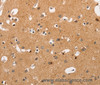 Immunohistochemistry of paraffin-embedded Human brain tissue using Crystallin-alpha C Polyclonal Antibody at dilution 1:45