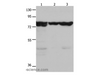 Western Blot analysis of Mouse kidney tissue, 293T and hela cell using HSP75 Polyclonal Antibody at dilution of 1:1500