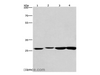 Western Blot analysis of Humna colon cancer and Mouse kidney tissue, Mouse testis and Human fetal brain tissue using KLF7 Polyclonal Antibody at dilution of 1:483.3
