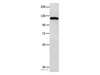 Western Blot analysis of 823 cell  using MVP Polyclonal Antibody at dilution of 1:350