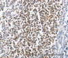 Immunohistochemistry of paraffin-embedded Human tonsil using MCM6 Polyclonal Antibody at dilution of 1:45
