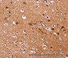 Immunohistochemistry of paraffin-embedded Human brain  tissue using MSH4 Polyclonal Antibody at dilution 1:30