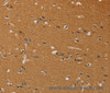 Immunohistochemistry of paraffin-embedded Human brain tissue using CHRNA4 Polyclonal Antibody at dilution 1:40