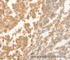 Immunohistochemistry of paraffin-embedded Human tonsil using NAP1L1 Polyclonal Antibody at dilution of 1:70
