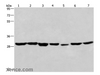 Western Blot analysis of 293T and A549 cell,Human liver cancer tissue and PC3 cell ,Human placenta tissue,hela cell and Mouse heart tissue using PHB Polyclonal Antibody at dilution of 1:350