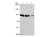 Western Blot analysis of Hela, 231 and 293T cell using PIWIL4 Polyclonal Antibody at dilution of 1:550