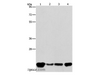 Western Blot analysis of A549, K562, hela and hepG2 cell using PEBP1 Polyclonal Antibody at dilution of 1:400
