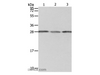 Western Blot analysis of A549 cell, Human liver cancer and fetal kidney tissue using PSMD9 Polyclonal Antibody at dilution of 1:800