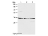 Western Blot analysis of NIH/3T3, A431 and Jurkat cell using RPLP0 Polyclonal Antibody at dilution of 1:750